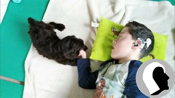 CI Kopf 2018 männlich Kind